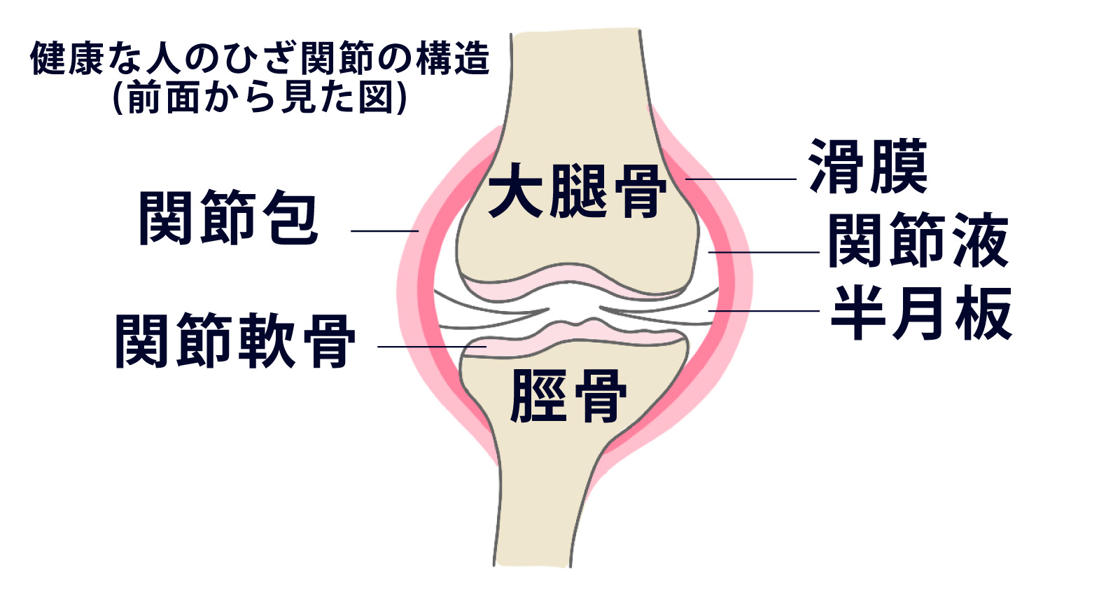 【変形性膝関節症とは】症状や原因、治療法、費用について | 日本の名医
